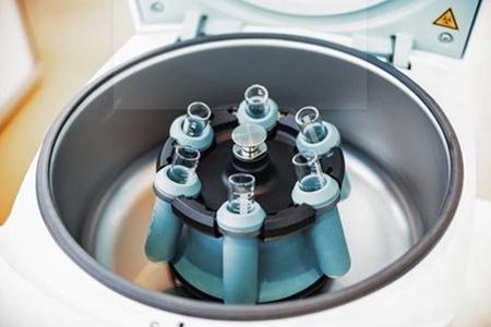 Centrifuge with platelet rich plasma therapy in Miami